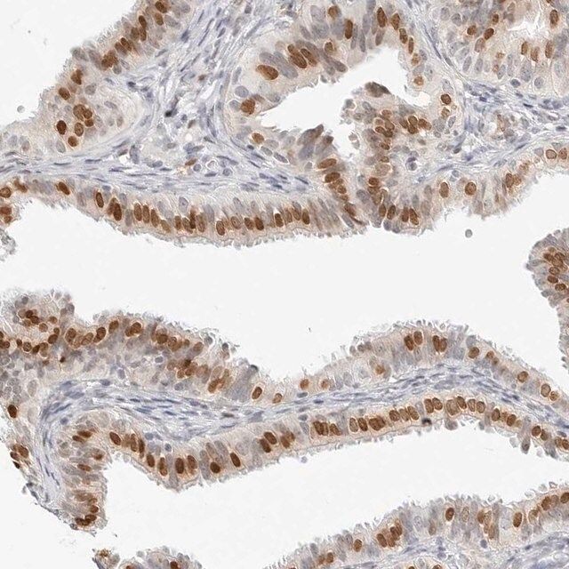 Anti-SPIDR antibody produced in rabbit