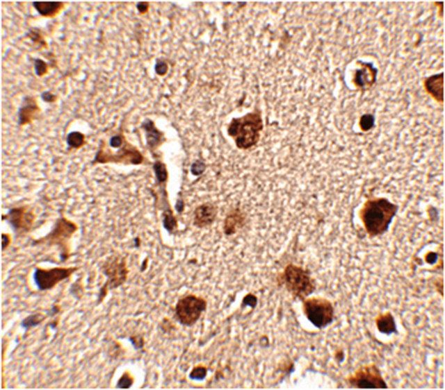 Anti-Slitrk4 Antibody