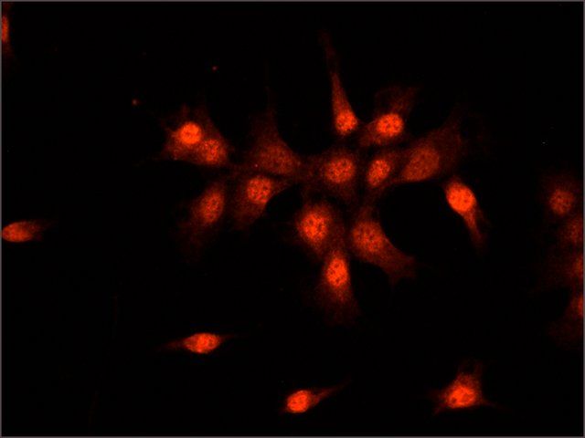 Anti-SMAD6 (N-terminal) antibody produced in rabbit