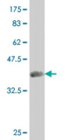 ANTI-SMAD4 antibody produced in mouse
