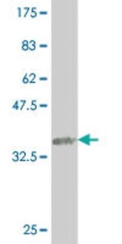 ANTI-SMAD4 antibody produced in mouse