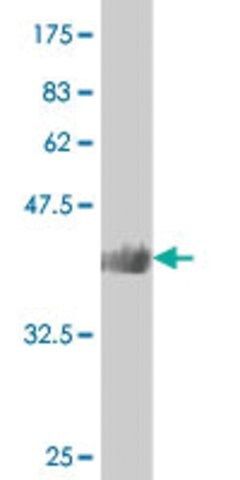 ANTI-SMAD4 antibody produced in mouse