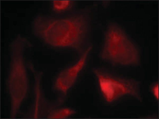 Anti-SMAD2 (Ab-467) antibody produced in rabbit