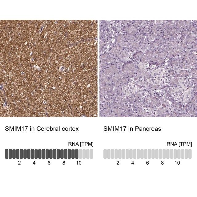 Anti-SMIM17 antibody produced in rabbit