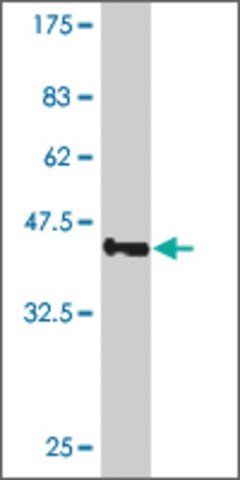 ANTI-SMO antibody produced in mouse