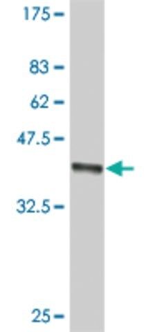 ANTI-SMO antibody produced in mouse