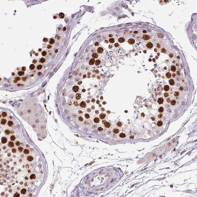 Anti-SMIM6 antibody produced in rabbit