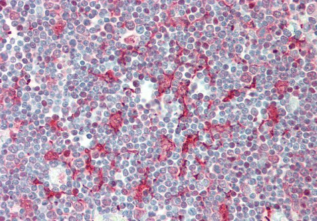 Anti-SMPD3 antibody produced in rabbit