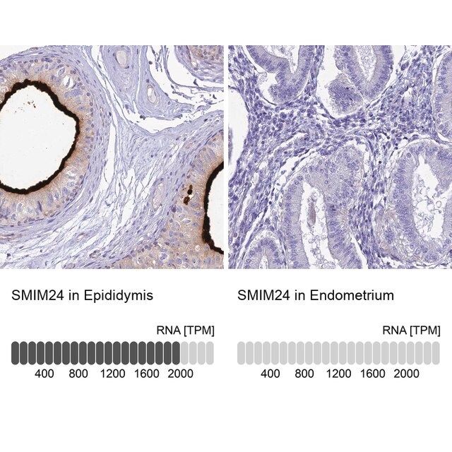 Anti-SMIM24 antibody produced in rabbit