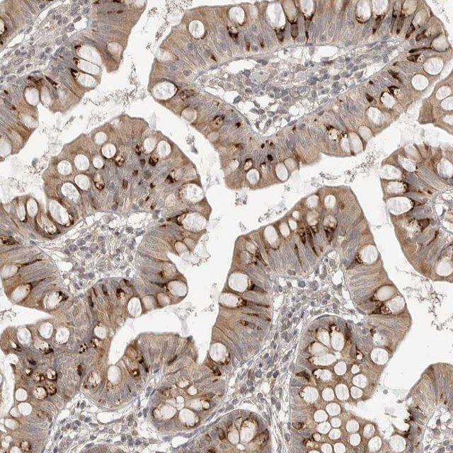 Anti-SMG8 antibody produced in rabbit