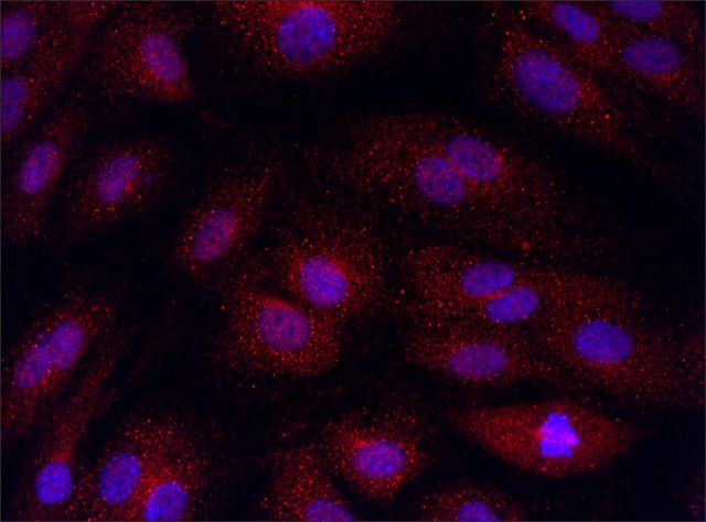 Anti-SMOX (151-165) antibody produced in rabbit