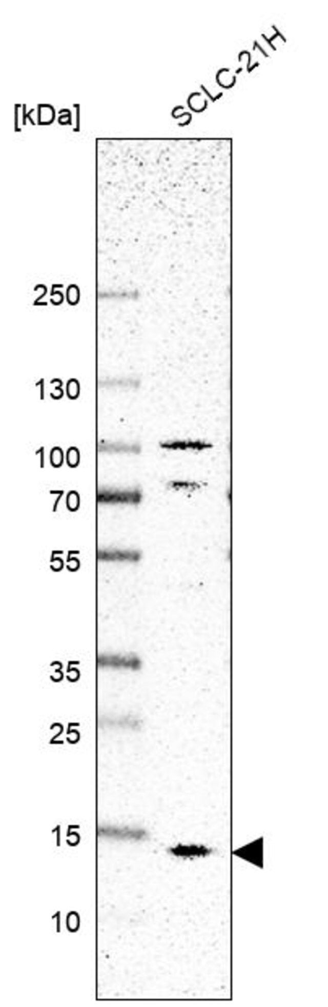 Anti-SMIM8 antibody produced in rabbit
