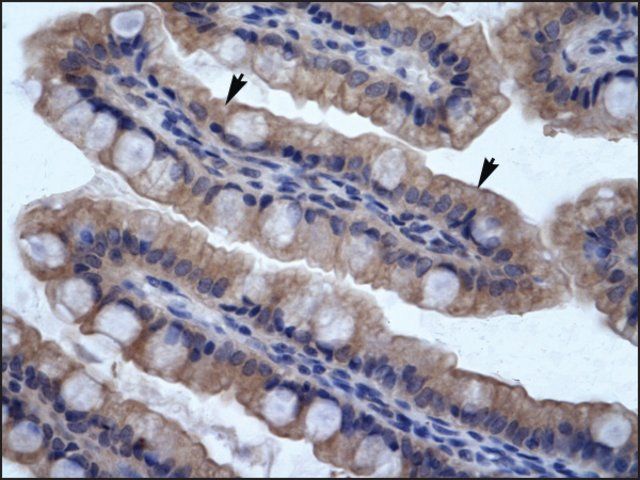 Anti-SMPDL3B antibody produced in rabbit