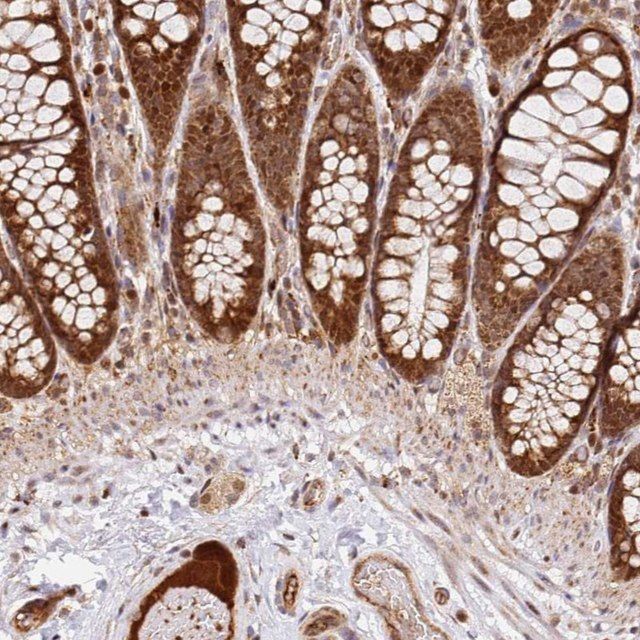 Anti-SMOX antibody produced in rabbit