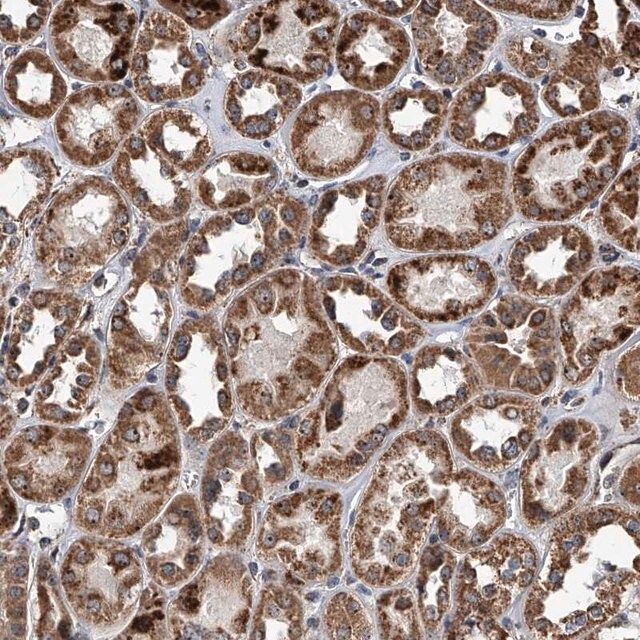 Anti-SMPDL3A antibody produced in rabbit