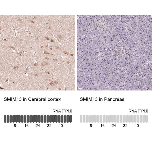 Anti-SMIM13 antibody produced in rabbit