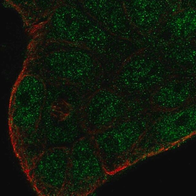 Anti-SMIM22 antibody produced in rabbit
