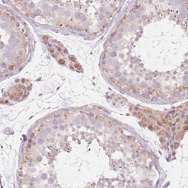 Anti-SMPD4 antibody produced in rabbit