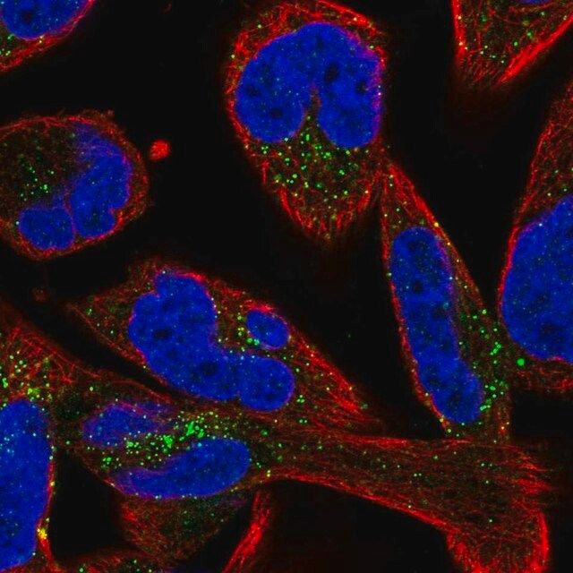 Anti-SMIM17 antibody produced in rabbit
