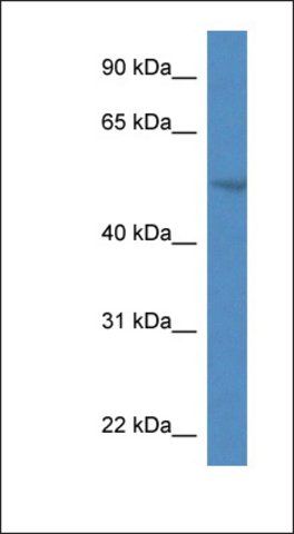 Anti-SMPDL3A antibody produced in rabbit