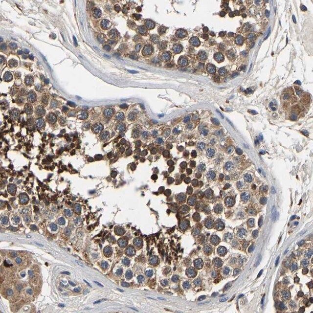 Anti-SMPD2 antibody produced in rabbit