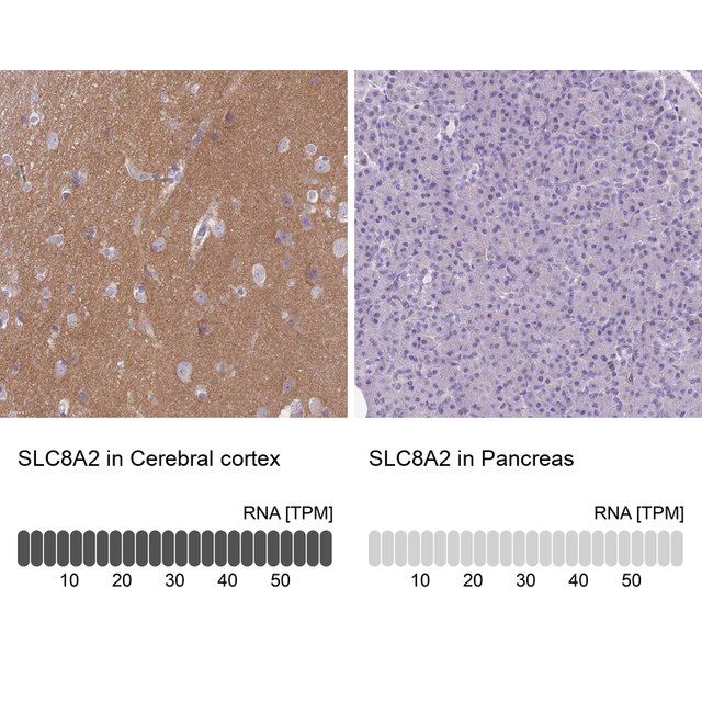 Anti-SLC8A2 antibody produced in rabbit