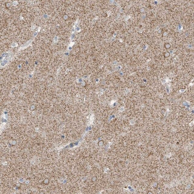 Anti-SLC25A23 antibody produced in rabbit
