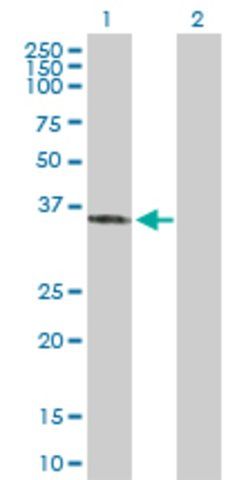 Anti-SFXN3 antibody produced in rabbit