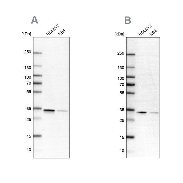 Anti-SFXN1 antibody produced in rabbit