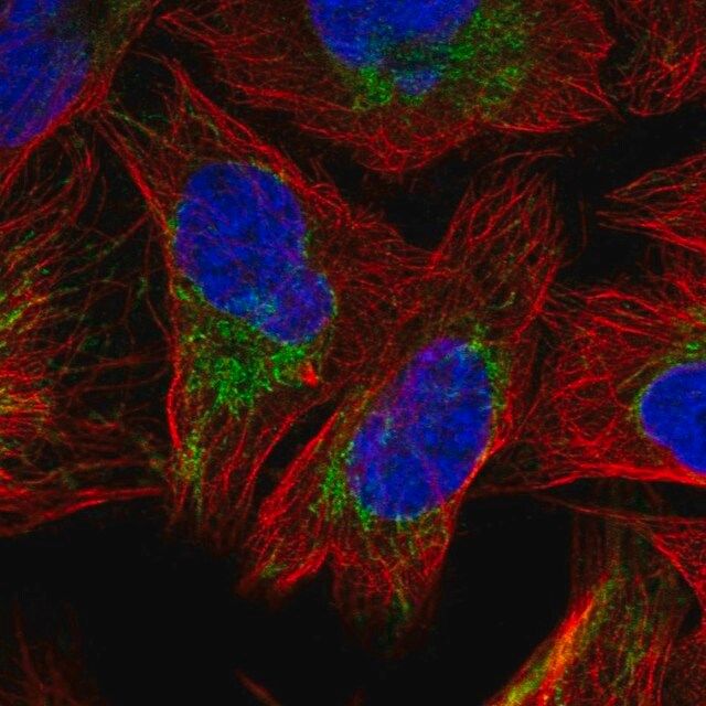 Anti-SFXN3 antibody produced in rabbit