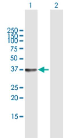 Anti-SGTB antibody produced in mouse