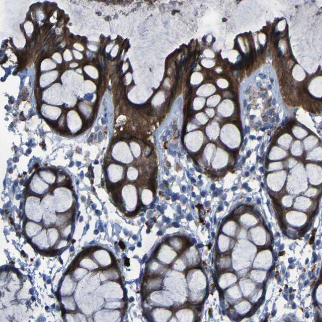 Anti-SGK2 antibody produced in rabbit