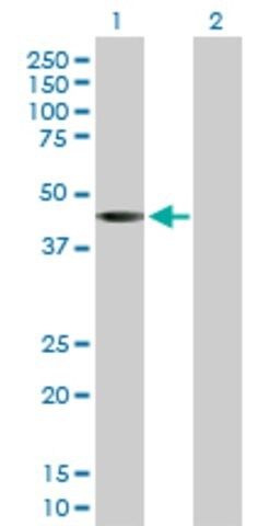 Anti-SGK2 antibody produced in rabbit