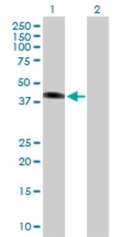 Anti-SGK2 antibody produced in mouse