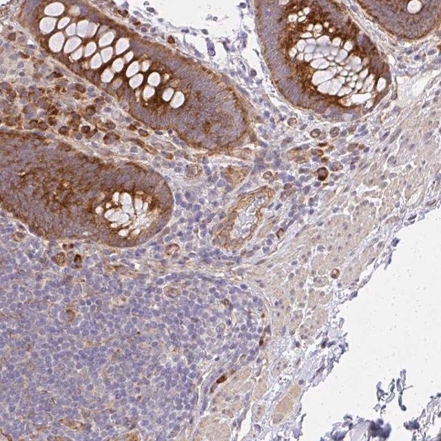 Anti-SGK494 antibody produced in rabbit