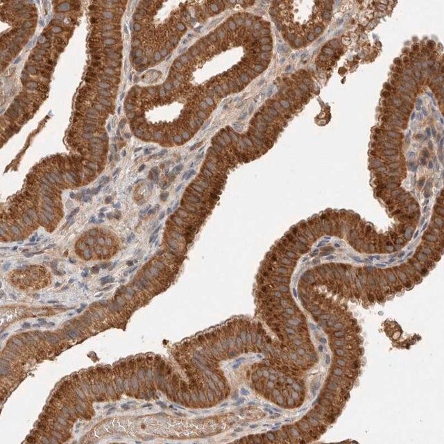 Anti-SGK3 antibody produced in rabbit