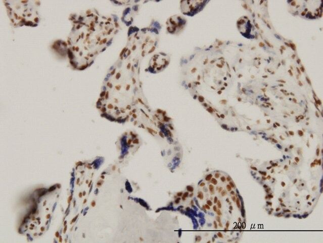 ANTI-SGK antibody produced in mouse