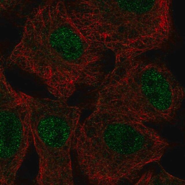 Anti-SGK2 antibody produced in rabbit