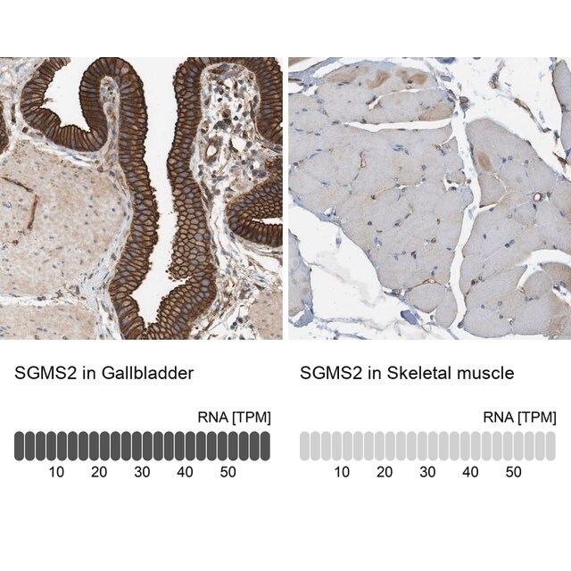 Anti-SGMS2 antibody produced in rabbit