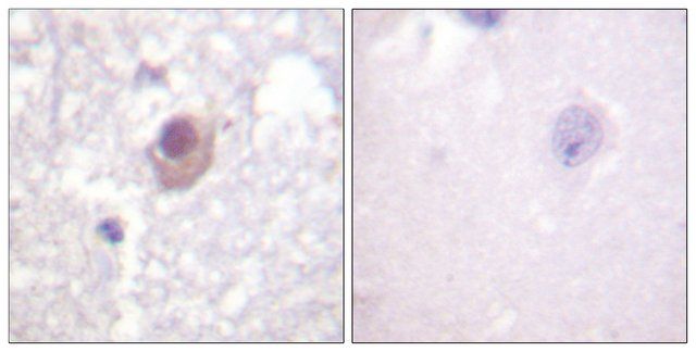 Anti-SGK antibody produced in rabbit