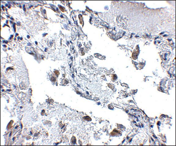 Anti-SH3BP4 antibody produced in rabbit