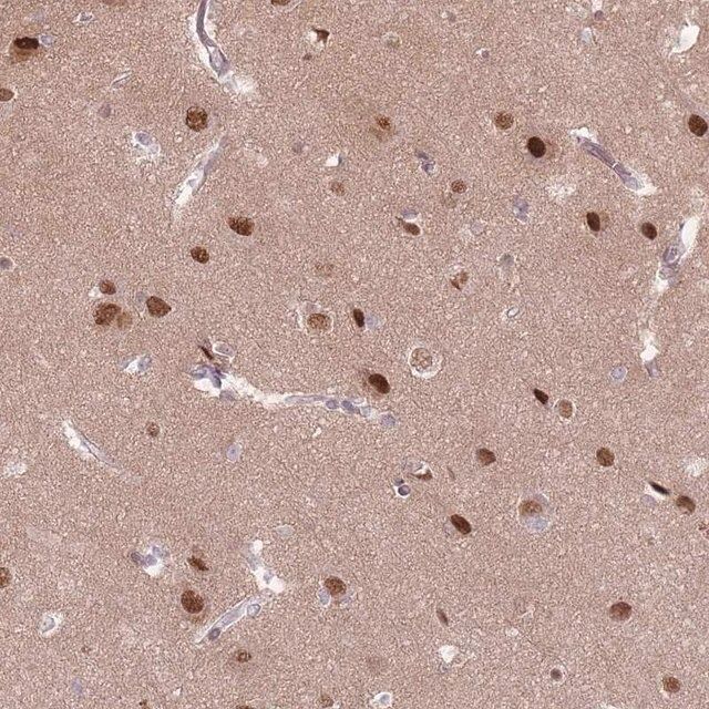 Anti-SH3BGRL2 antibody produced in rabbit