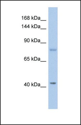 Anti-SH2D3C, (N-terminal) antibody produced in rabbit