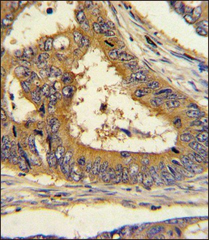 ANTI-SCAP (CENTER) antibody produced in rabbit