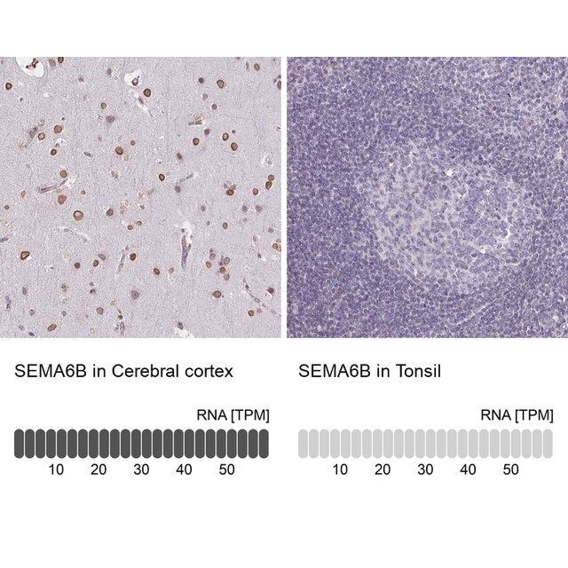 Anti-SEMA6B antibody produced in rabbit