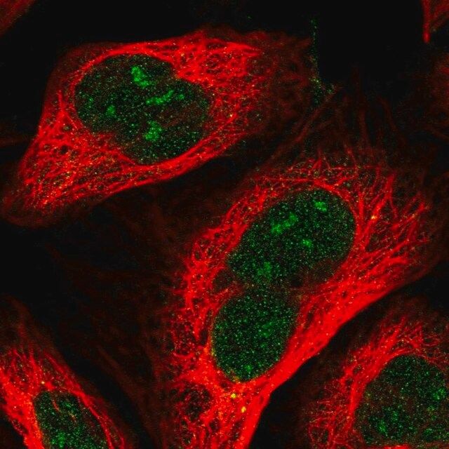 Anti-RRP36 antibody produced in rabbit