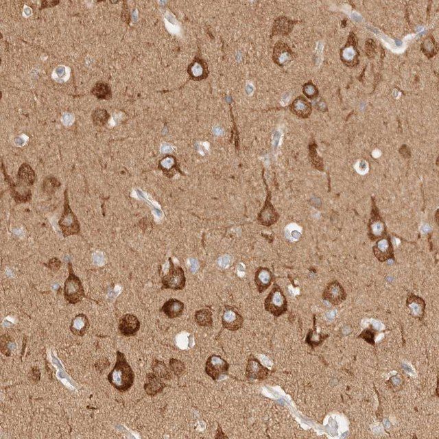 Anti-RRP15 antibody produced in rabbit