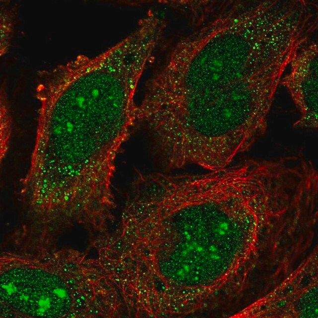 Anti-RRP8 antibody produced in rabbit