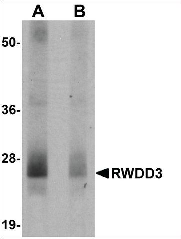 Anti-RWDD3 antibody produced in rabbit
