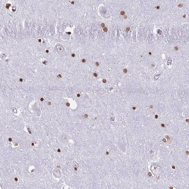 Anti-RYK antibody produced in rabbit